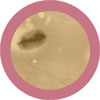 E.Coli